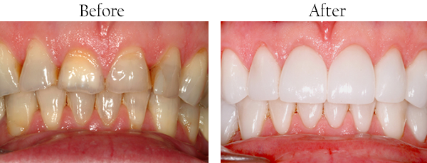 dental images 07601