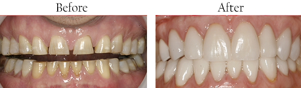 Hackensack Dental Images