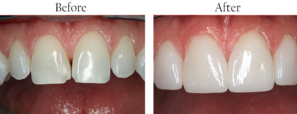 Hackensack Dental Images